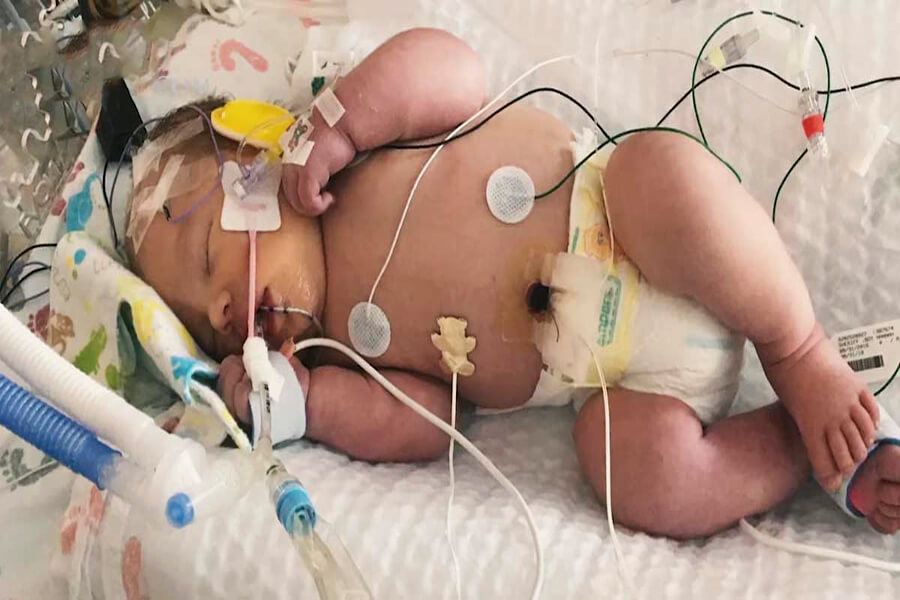 Bé Uriah đã chết trong 20 phút và sống lại nhờ sự cầu nguyện, Các phép lạ của Chúa Giêsu, Phép lạ