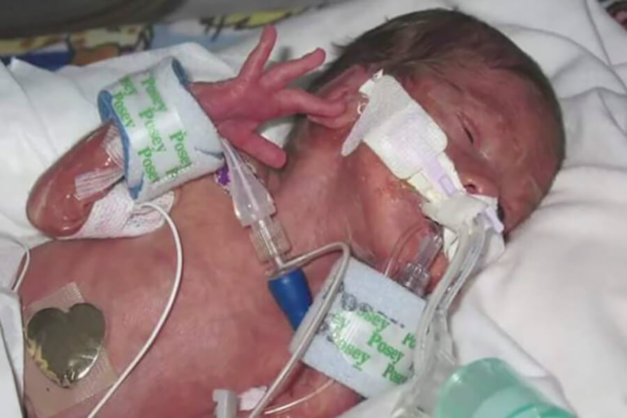 Bé Uriah đã chết trong 20 phút và sống lại nhờ sự cầu nguyện, Các phép lạ của Chúa Giêsu, Phép lạ